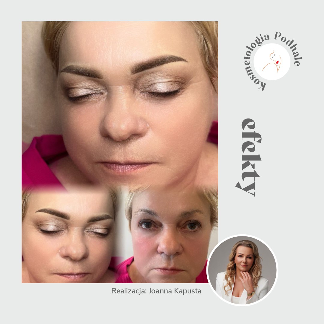 Efekty Kosmetologia Podhale